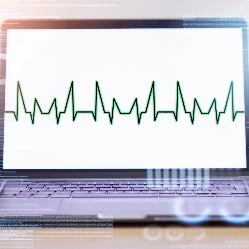 Laptop Displaying Heartbeat